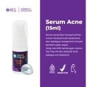 SERUM ACNE