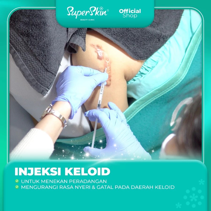 KELOID INJECT (FOA)