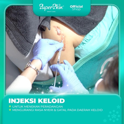 [OBT0048A] KELOID INJECT (FOA)