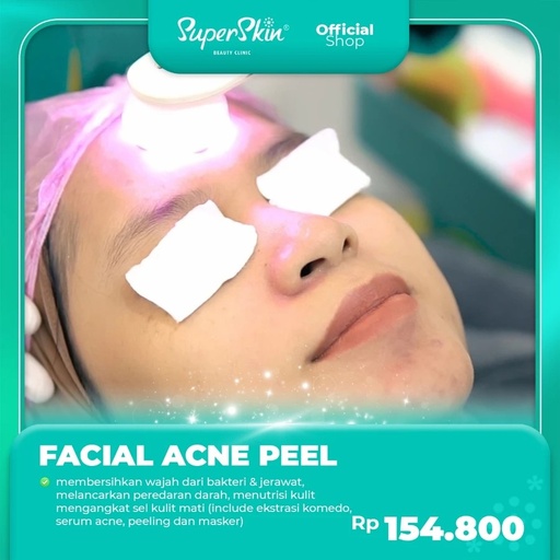 [PWT0025P] PAKET FACIAL ACNE PEEL SERUM (TUBAN)